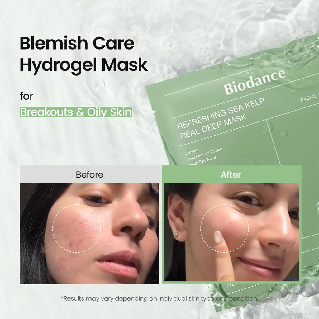Refreshing Sea Kelp Real Deep Mask, Overnight Hydrogel Face Mask, Calming, Oil & Sebum Control, Blemish Care, after Sun Care, Sunburn Relief, Korean Skin Care | 1.19Oz(34G) X 4Ea